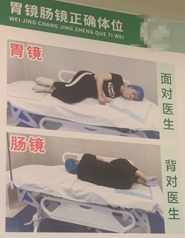 常见的检查包括胃镜,结肠镜,食管镜和小肠镜