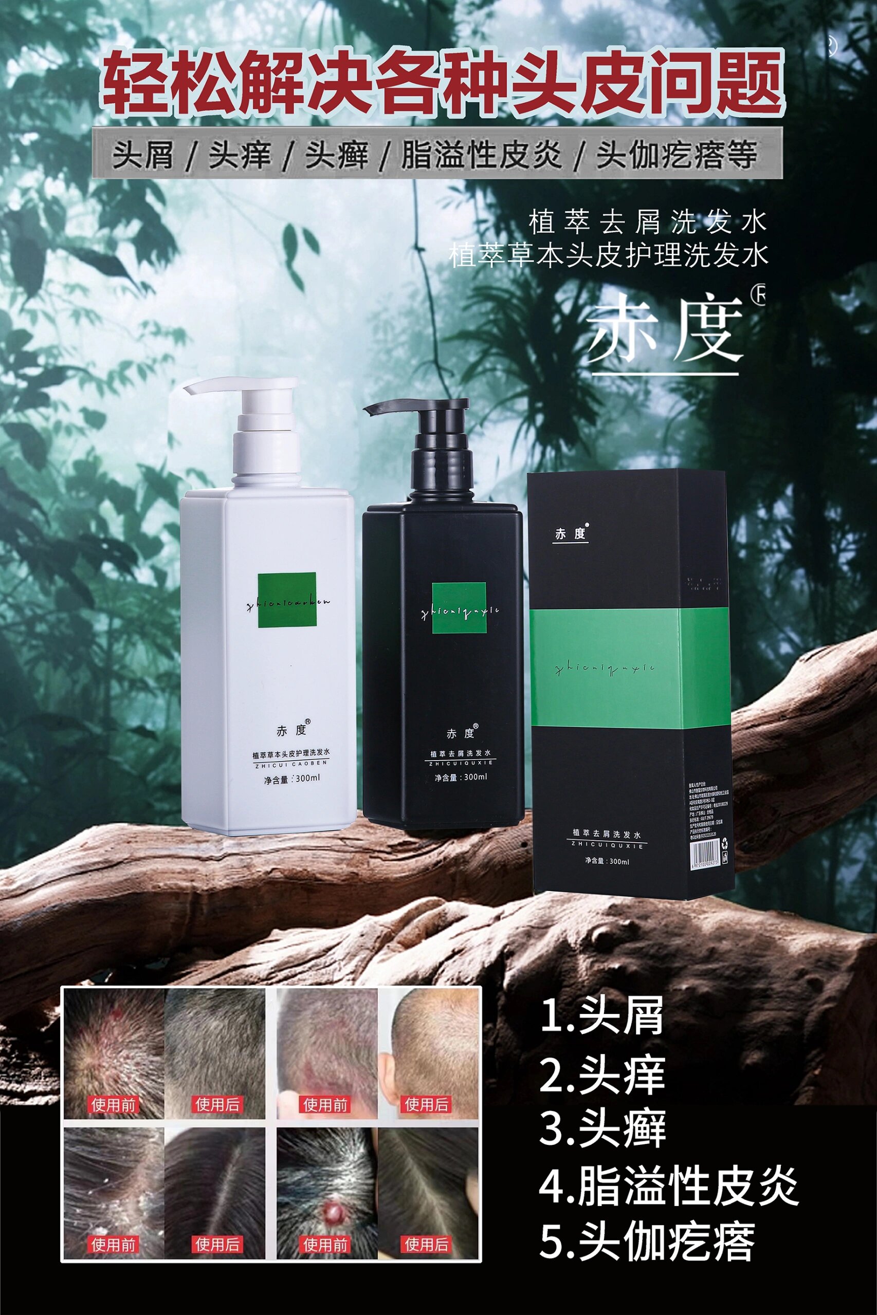 赤度植萃去屑洗发水赤度植萃头皮护理洗发水