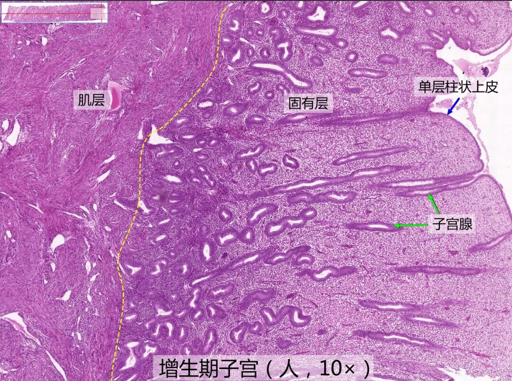 宫颈组织结构分层图片