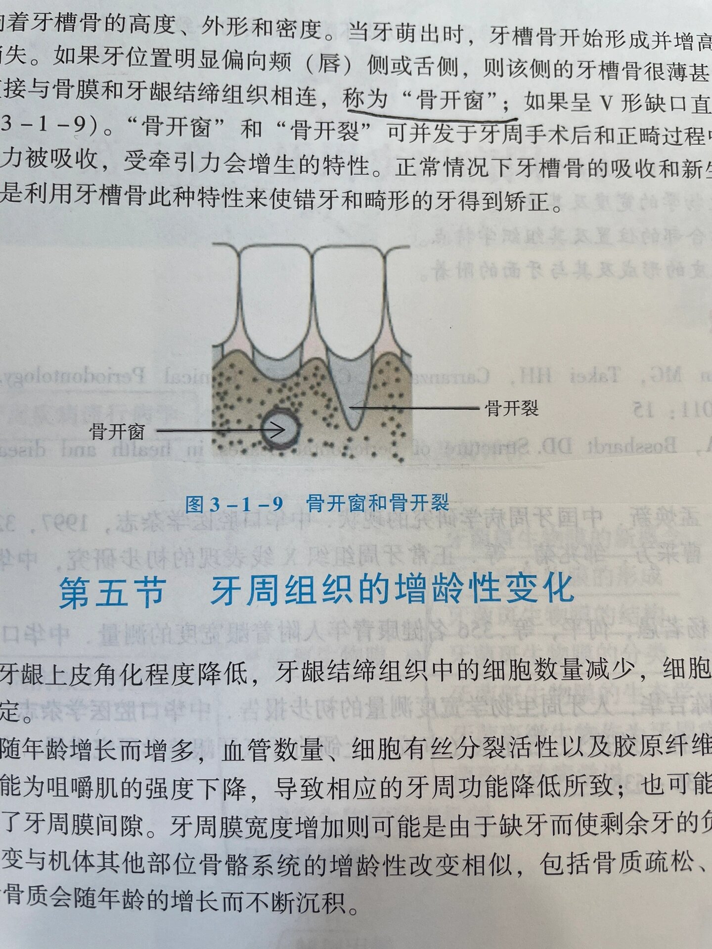 2065牙周膜:又称牙周韧带,是围绕牙根并连接牙骨质和牙槽骨的致密