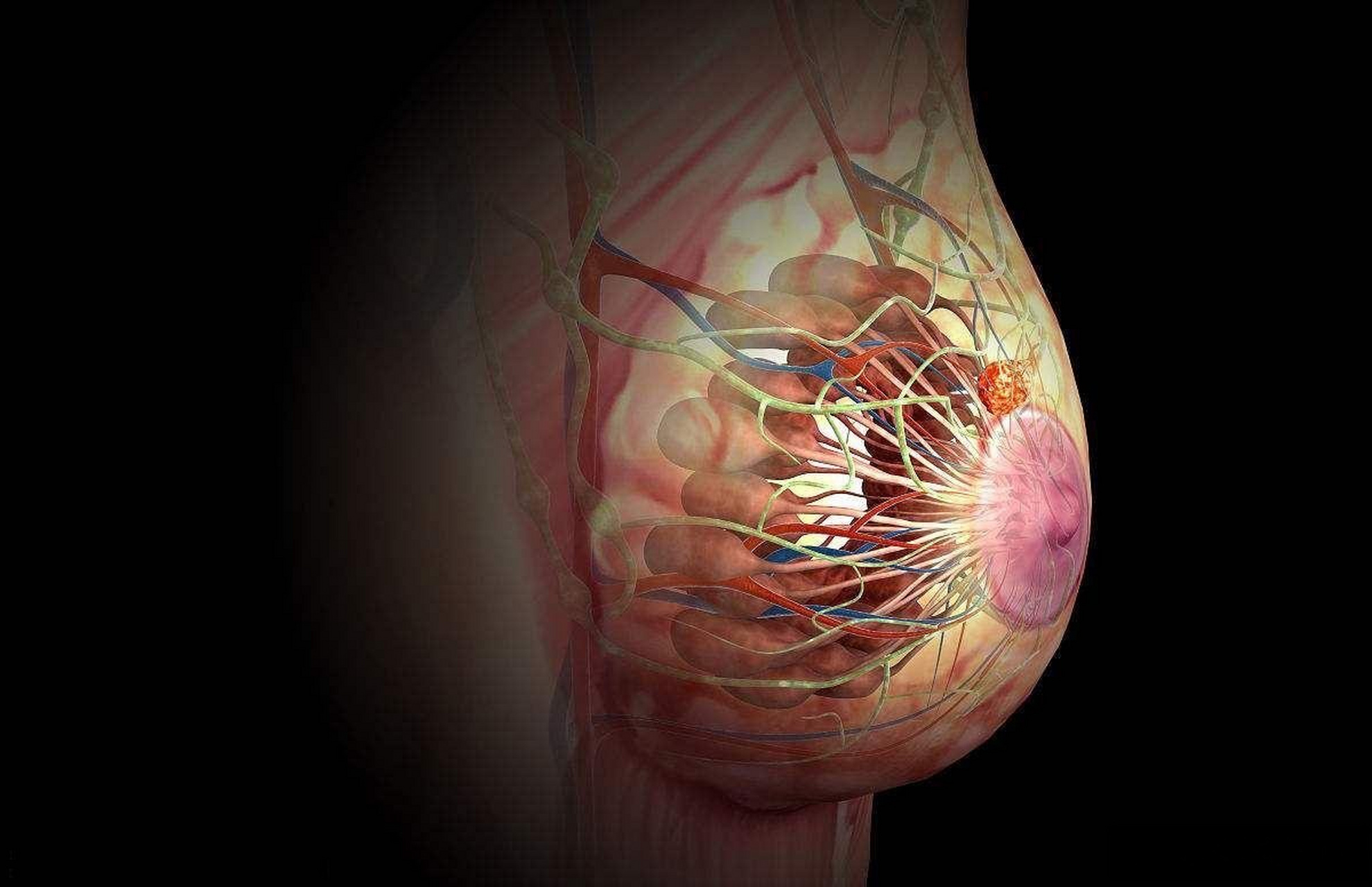 问题描述:我是一名乳腺癌患者,刚刚做过全切手术,伤口恢复的比较慢