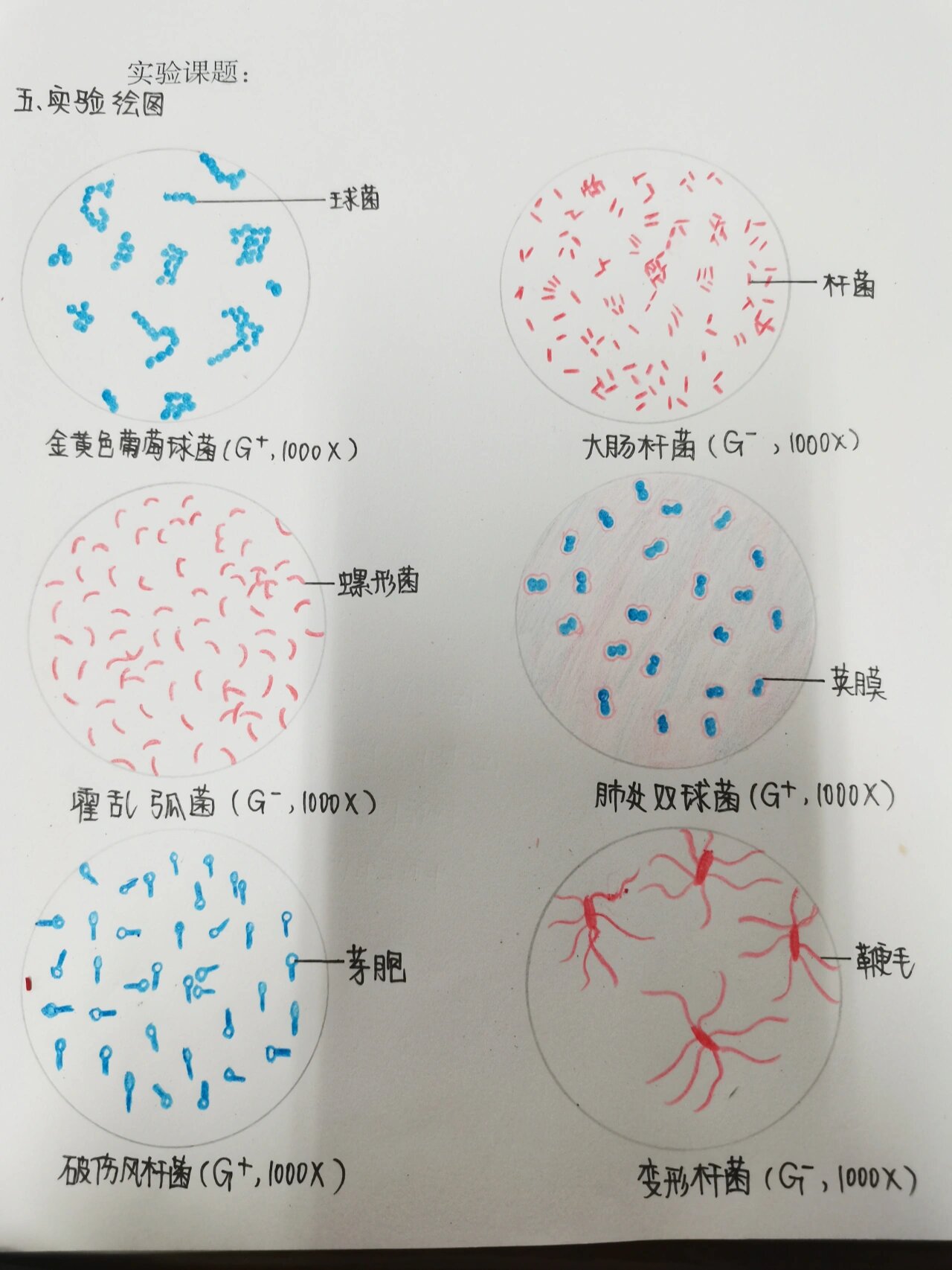 葡萄胎红蓝铅笔图图片