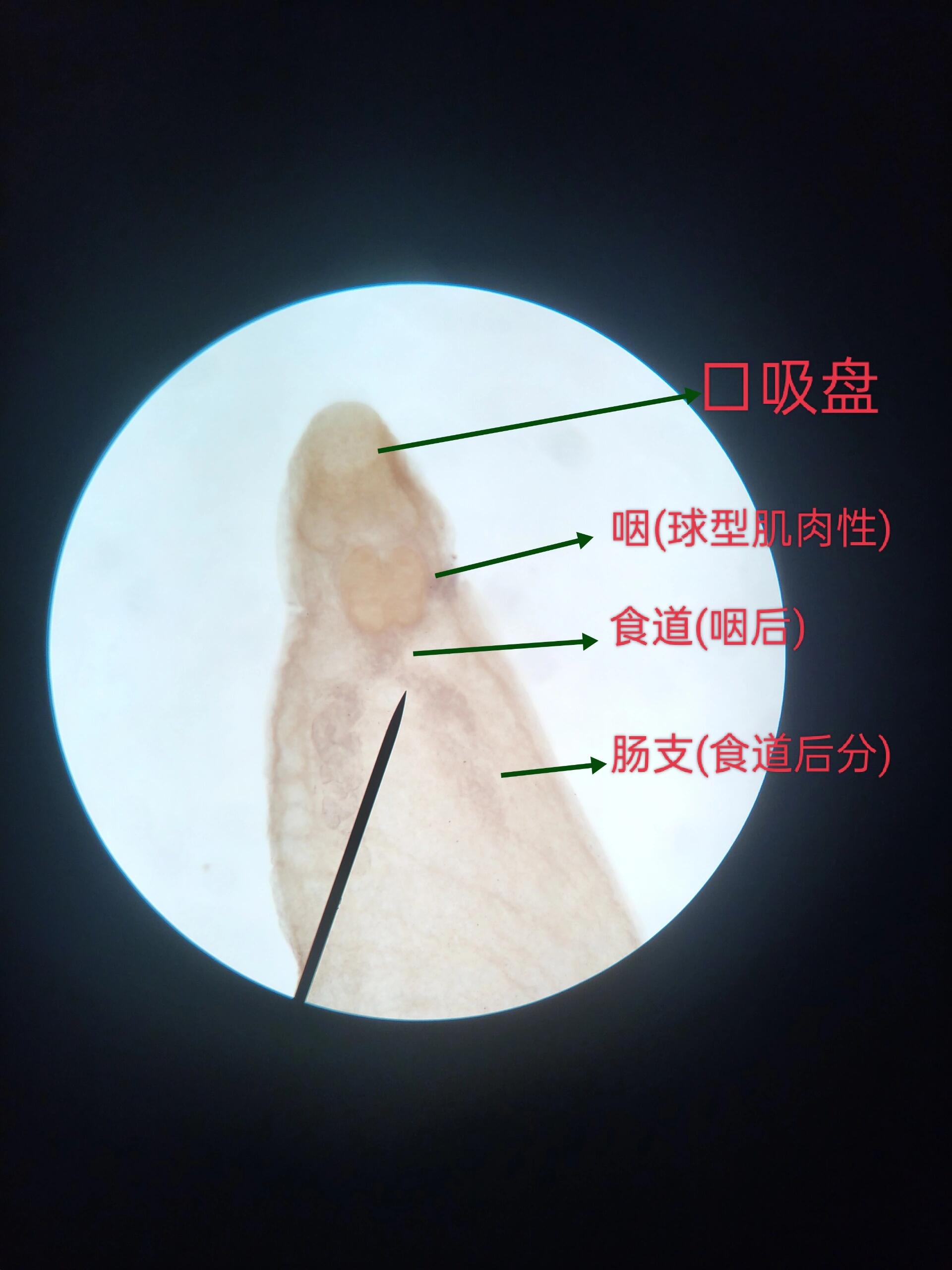 华支睾吸虫成虫