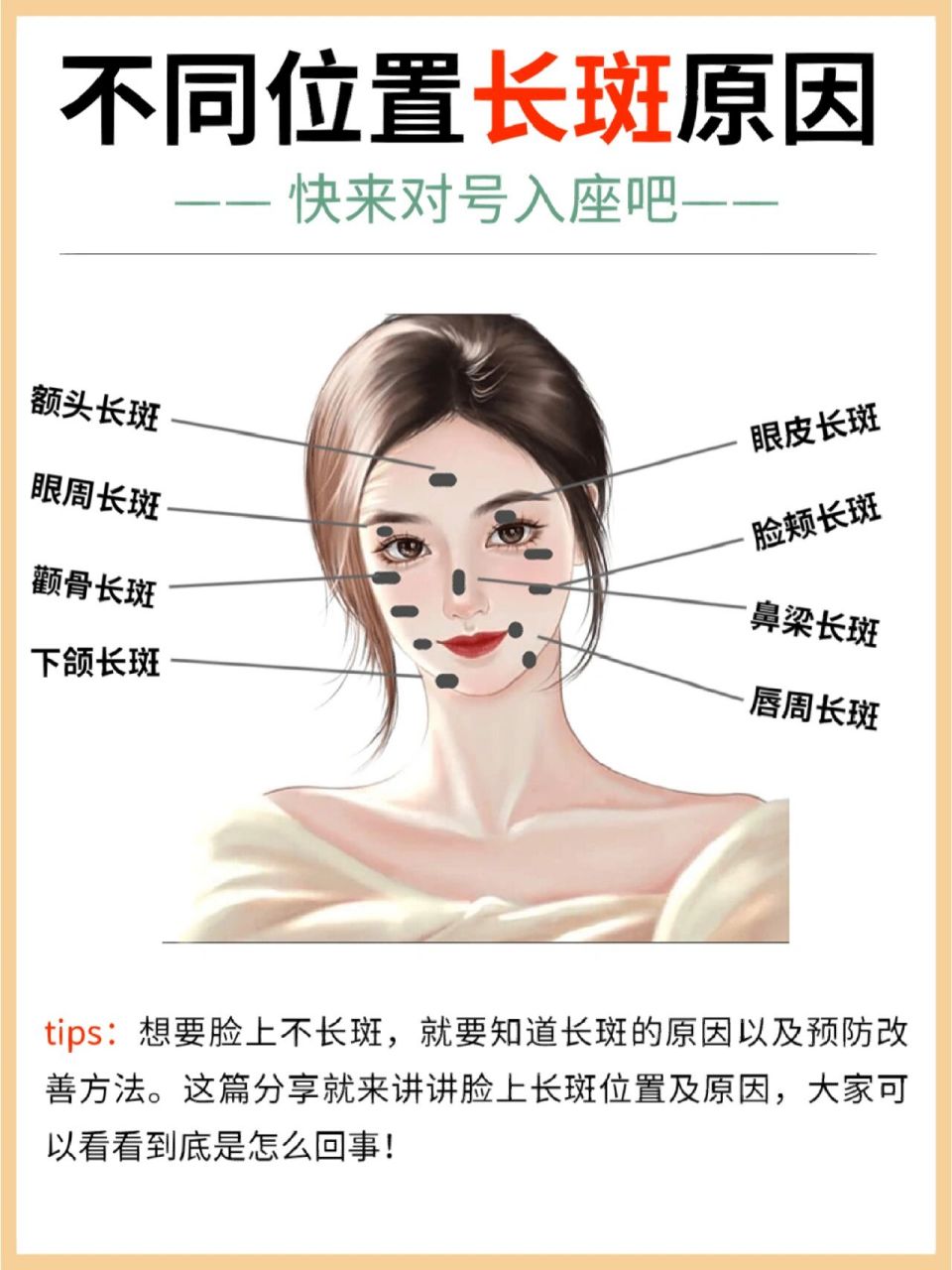 8个位置长斑的原因及建议‼️超详细科普✅ 脸上长斑是每个爱美