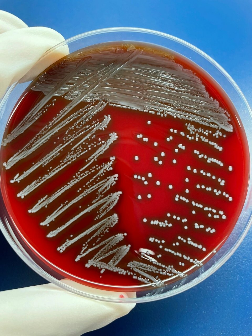 每日一菌-10 来源: 图12:分离自尿液中的屎肠球菌 图34:分离自尿液中