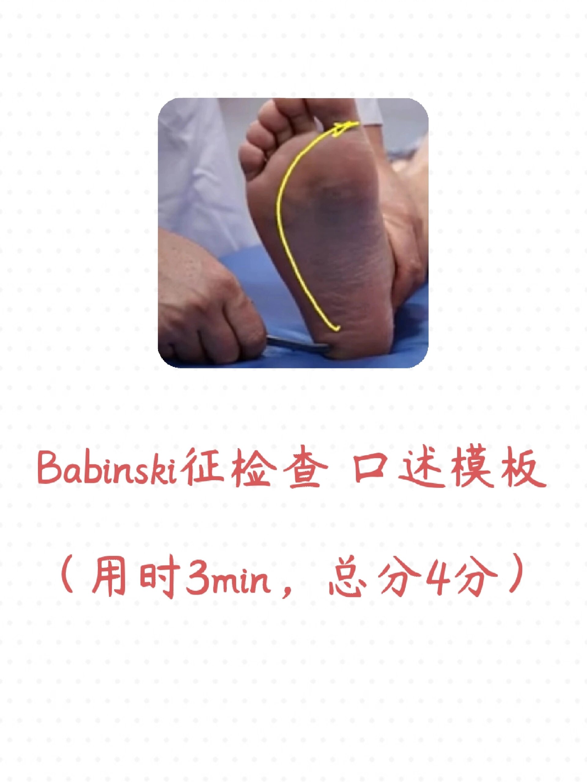 报告考官:考生抽到题目为babinski征检查.