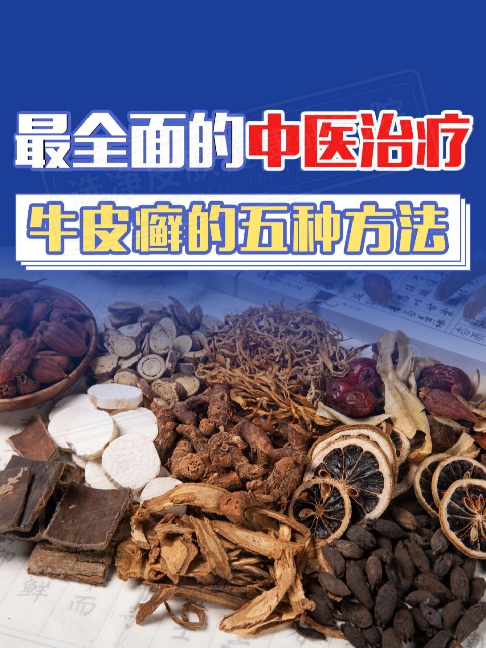 中医治疗牛皮癣的五种方法‼️ 🔵血热型 此型多见于进行期