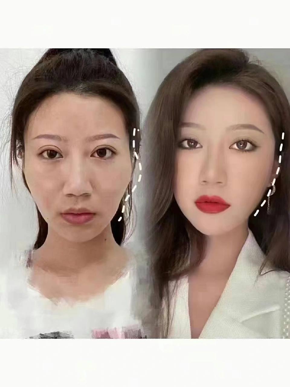 全脸凹陷=苦命人 93 面相大师说,全脸凹陷=苦命人 额头,太阳穴,脸颊