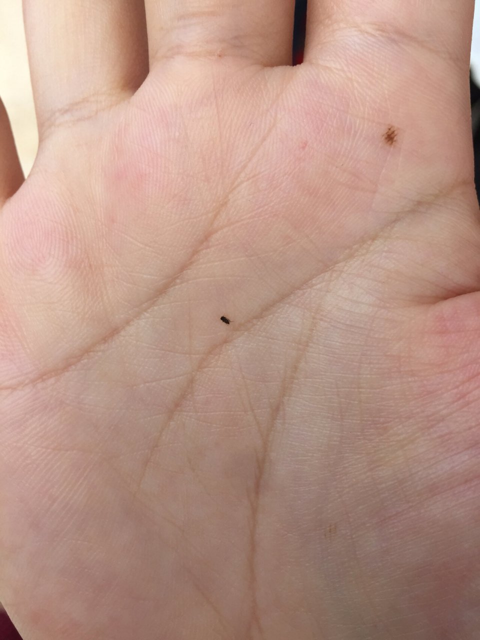 咬人的小黑虫 这到底是什么虫子啊 不是跳蚤!