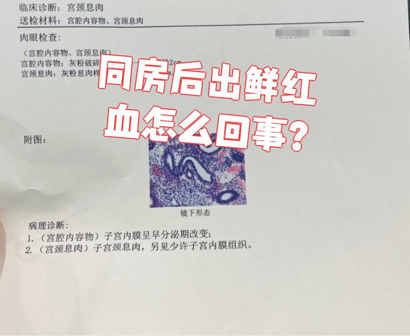 两个人同房后为什么会有血