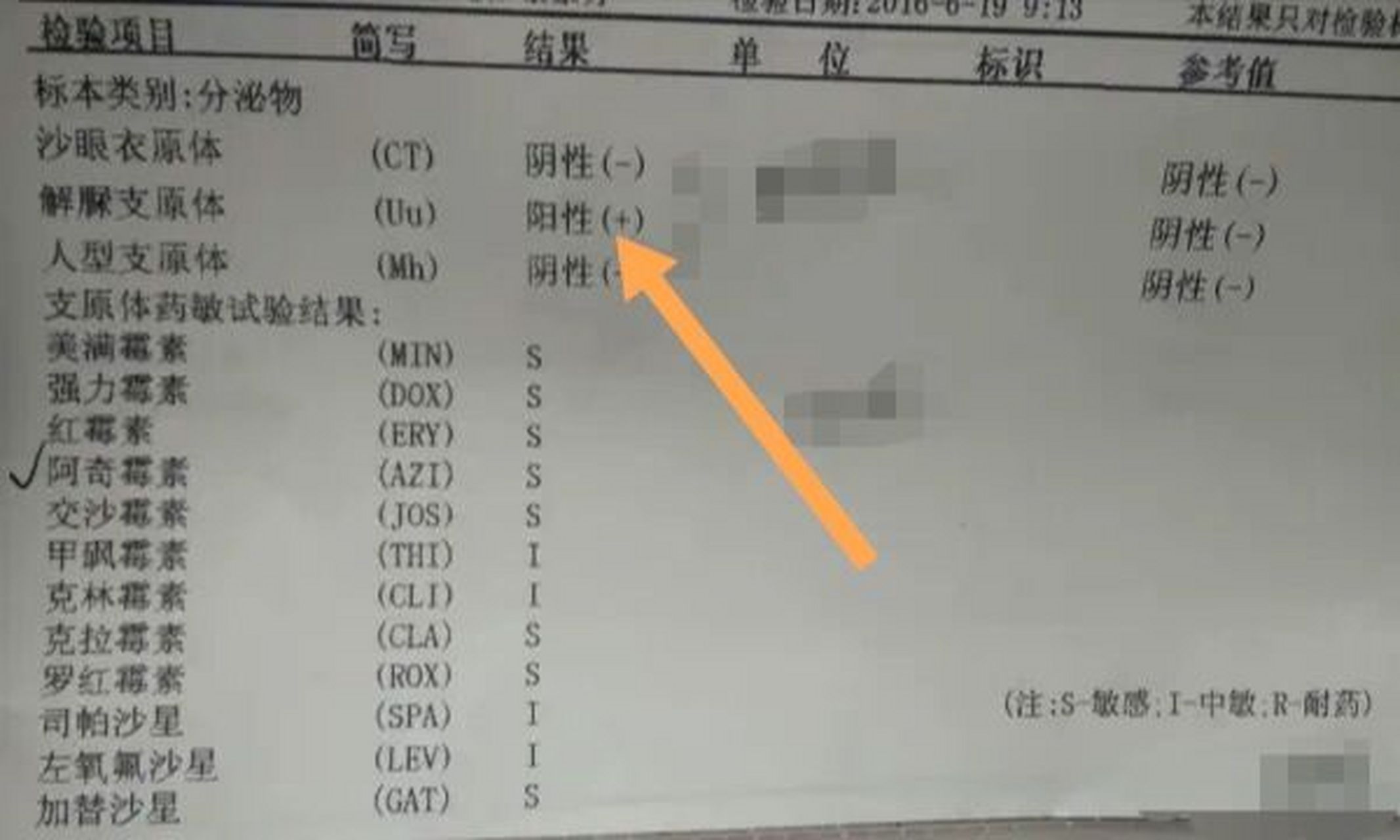解脲支原体可以通过夫妻生活,密切接触,分娩产道等方式传染,支原体