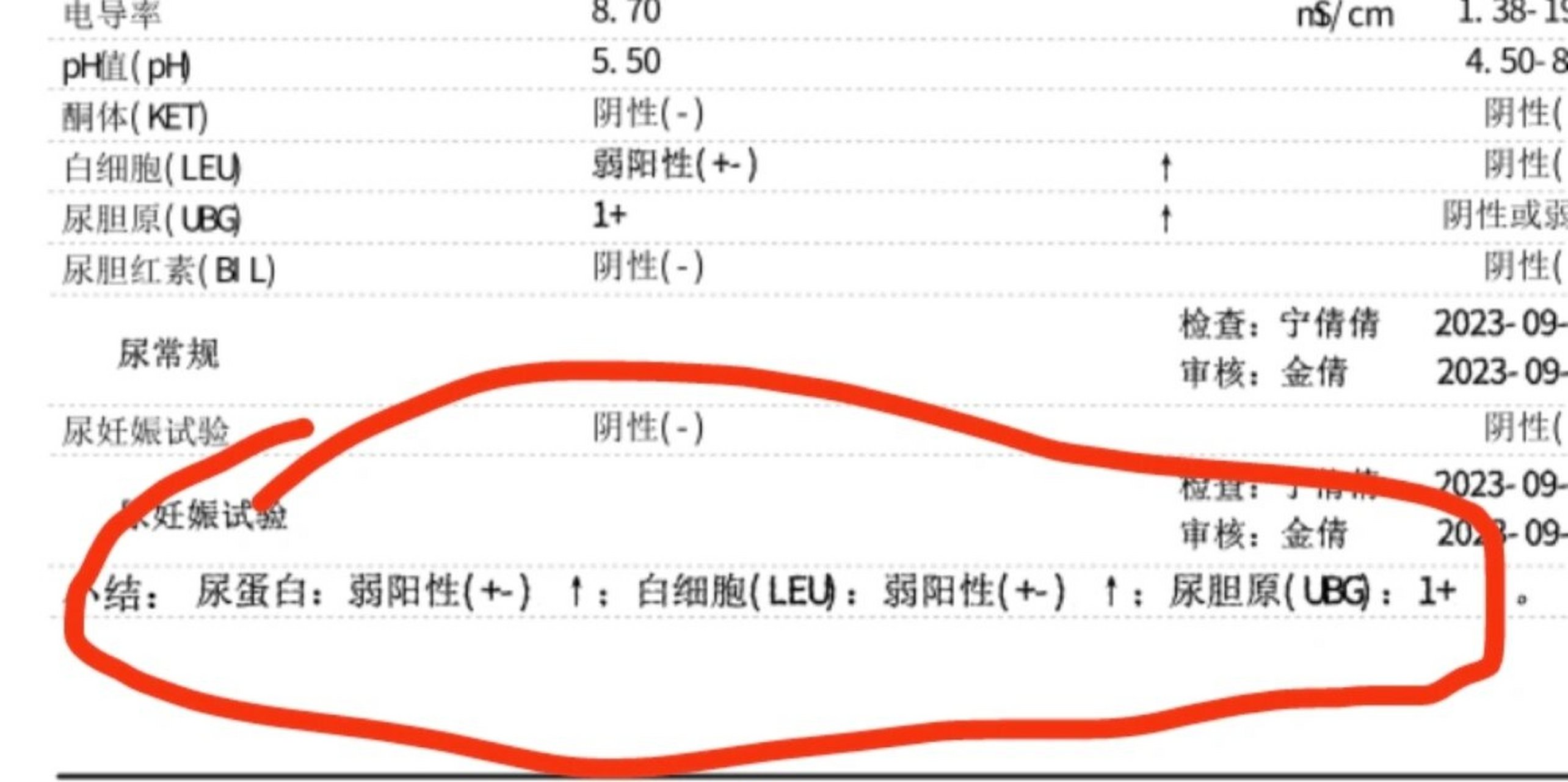 万能的友友们 尿检白细胞 尿胆原 尿蛋白弱阳性是啥意思啊?