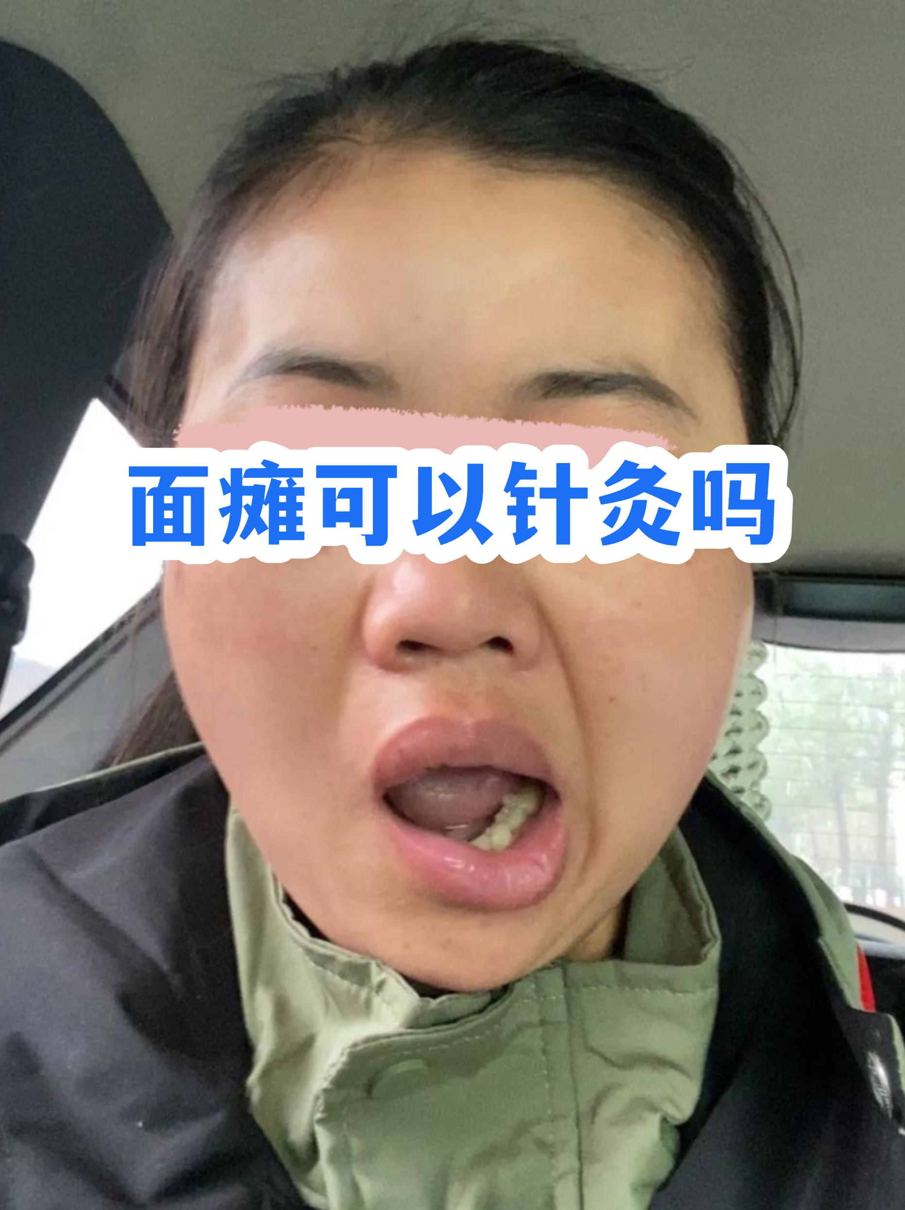 关于中国医学科学院阜外医院门诊陪诊挂号服务术后康复全程跟踪，恢复不走弯路的信息