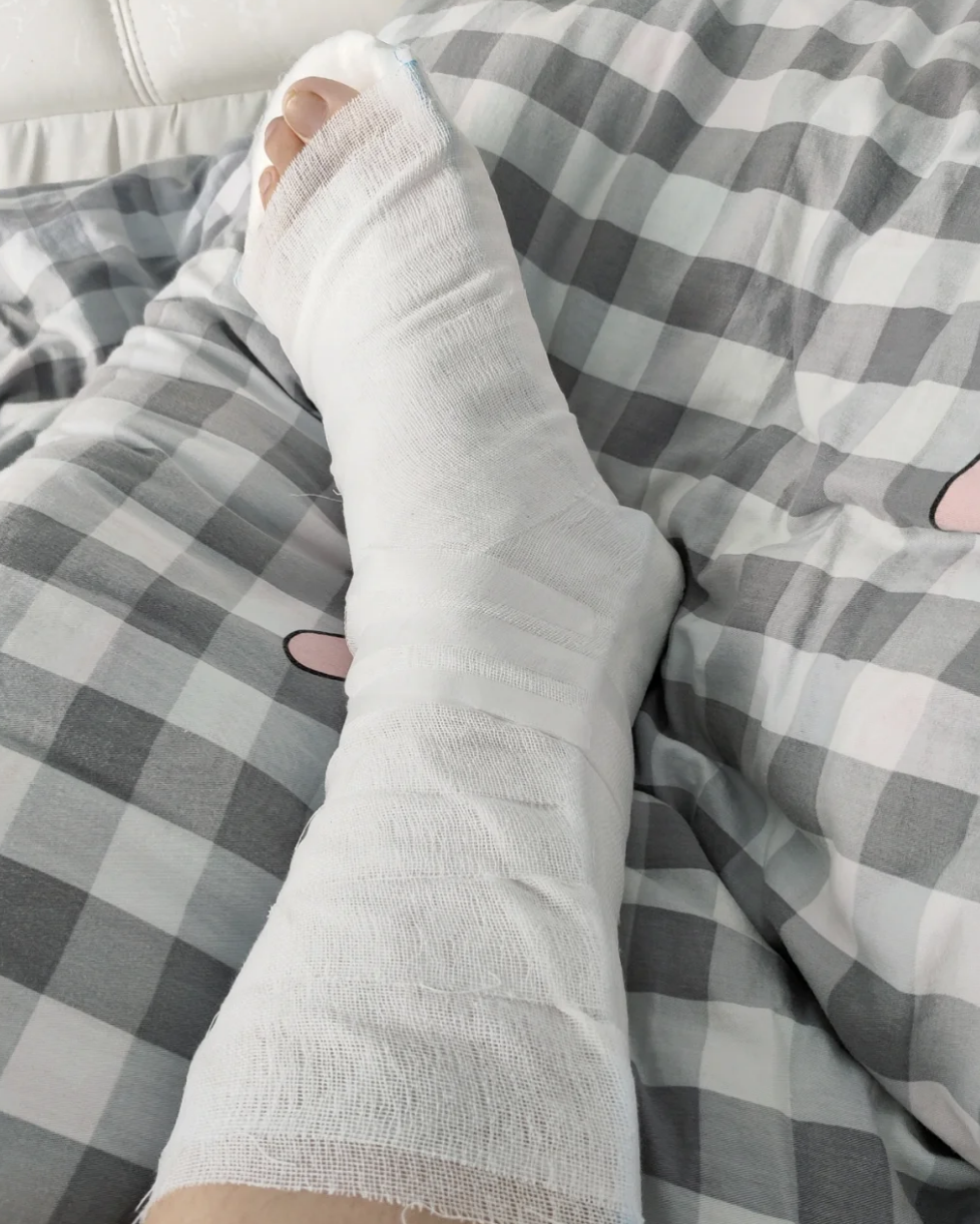 骨折手术后石膏固定太紧的话,可以试试这些方法: