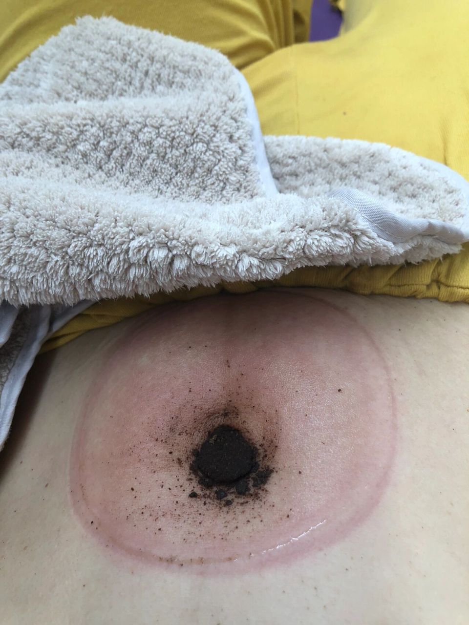 昨天给儿子也做了,专门的儿童调理脾胃的,今早又拉