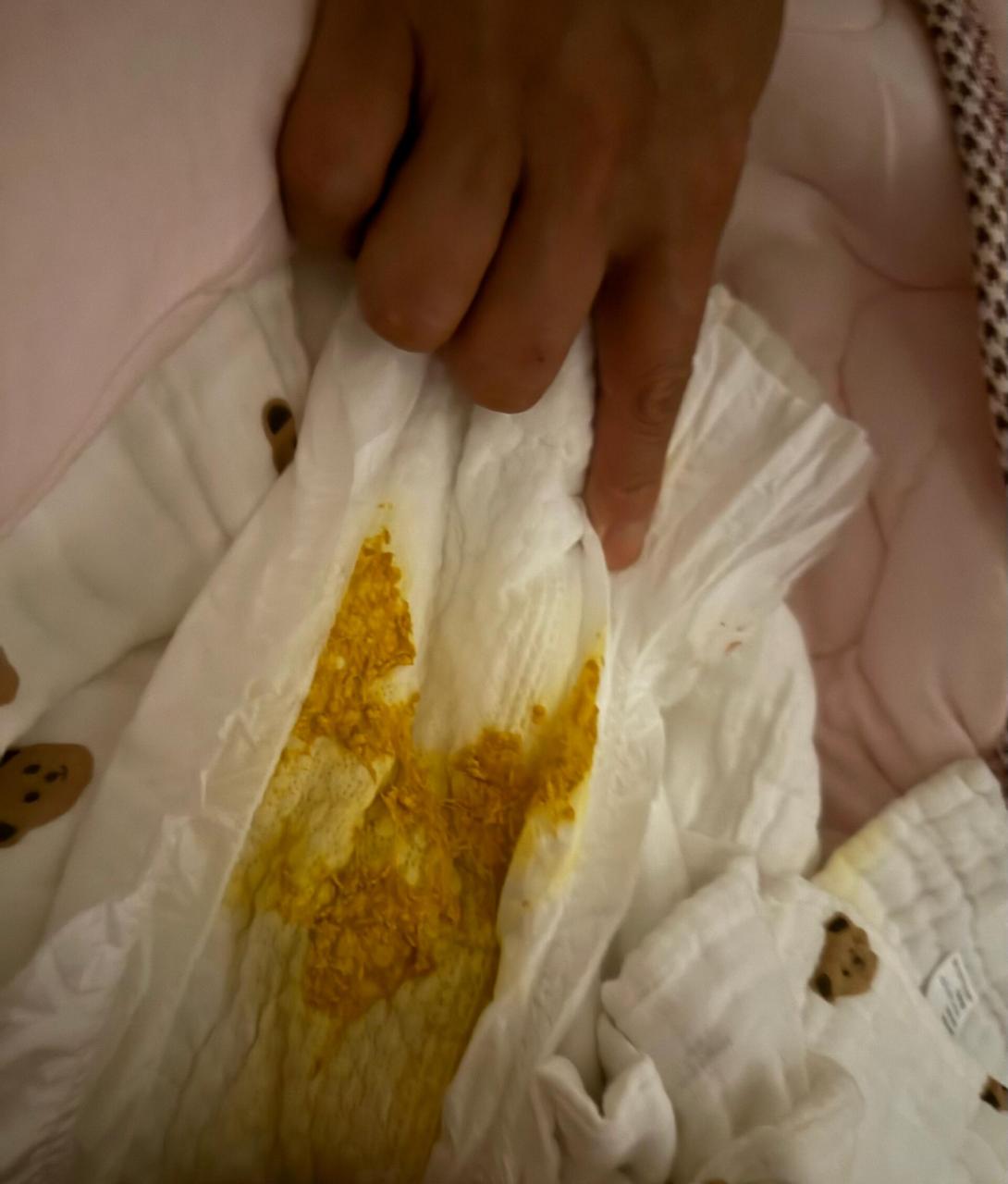 纯母乳喂养 月子里的宝宝拉奶瓣 放屁崩屎 图一图二是没喝益生菌拉的