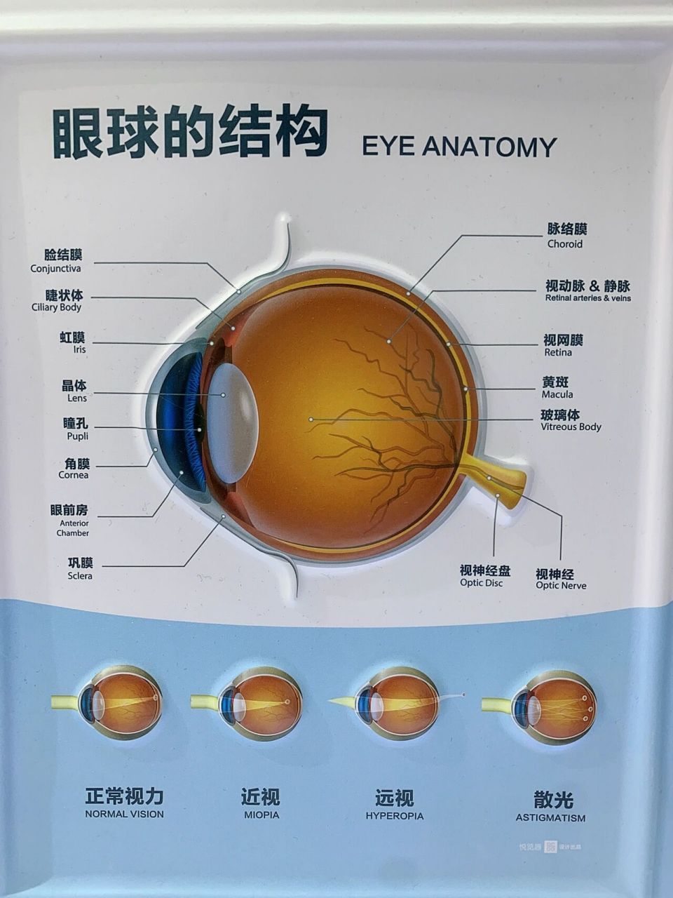 眼球的结构图 眼球是一个视觉器官,保养其健康尤为重要