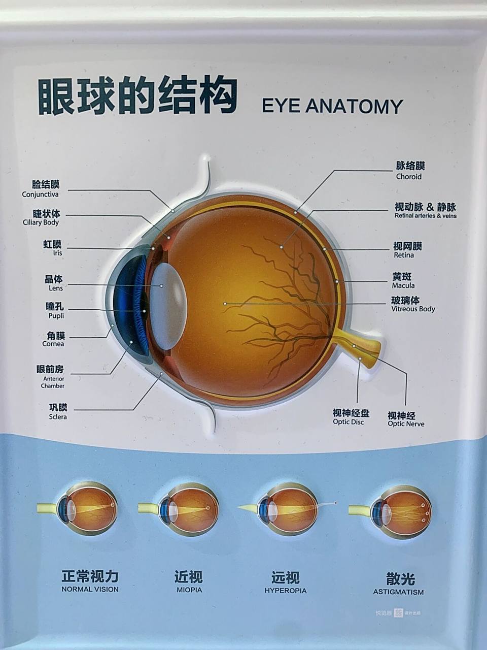 由于眼球属于三层膜组成的结构,内部有房水,玻璃体等液体或凝胶状结构
