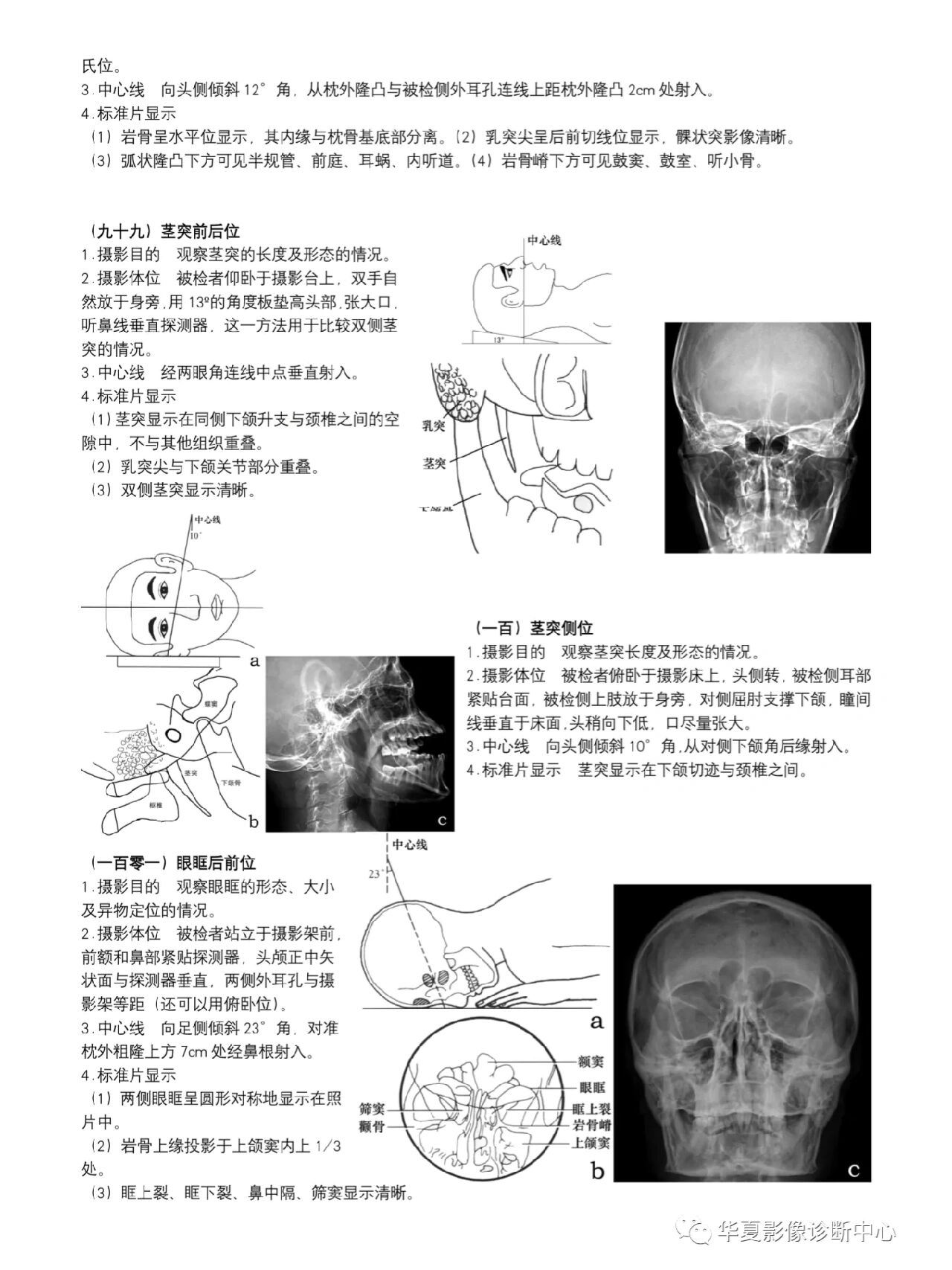 顶颌位的图解图片