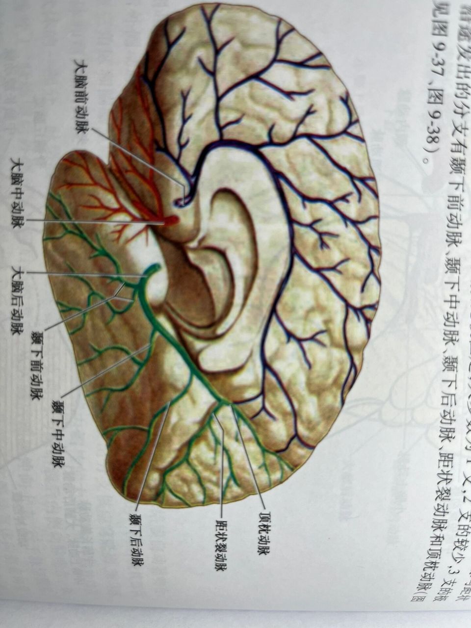 大脑后动脉TIA图片