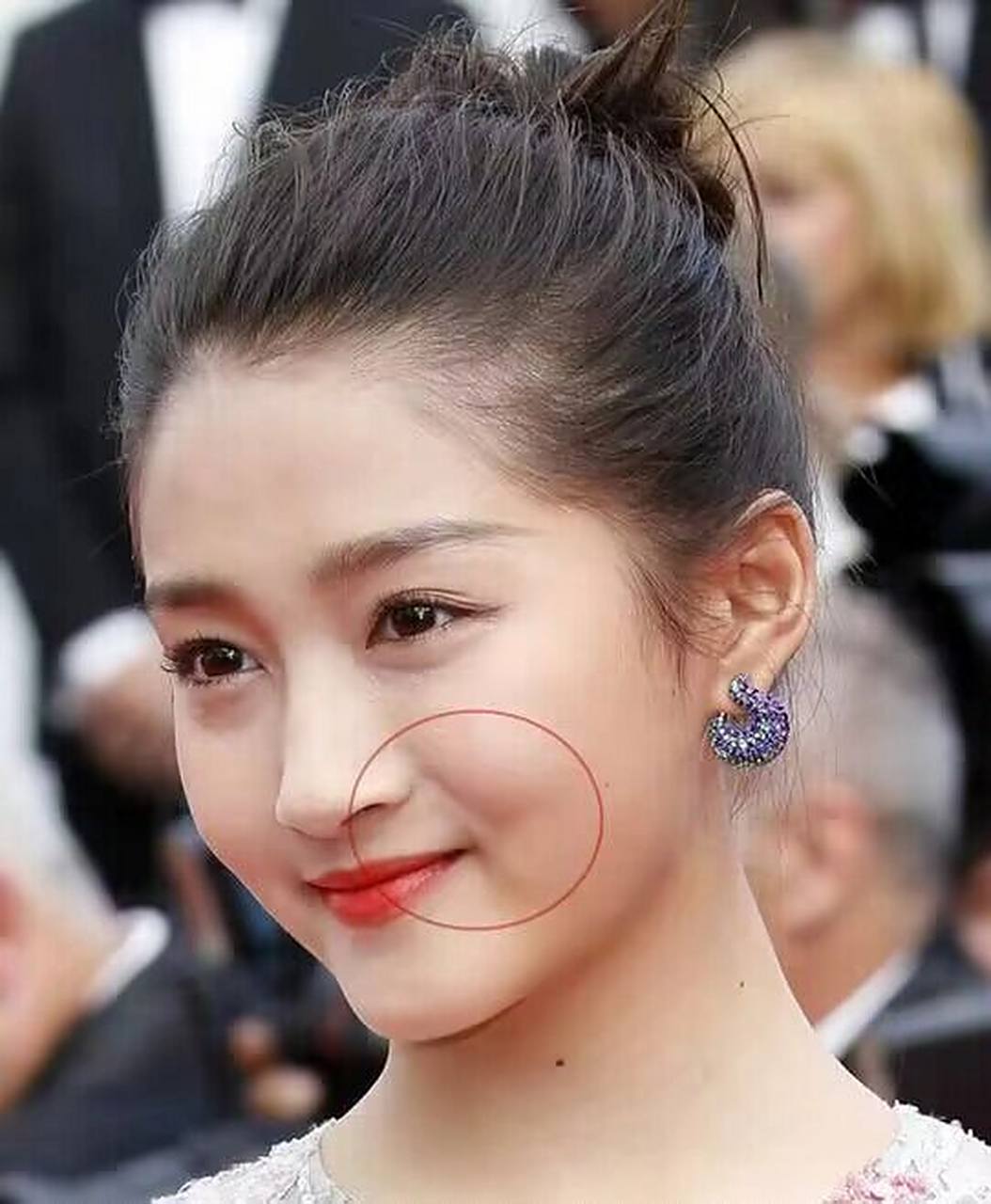 hey小姐姐,今天我要跟你们分享一下"法令纹"这个问题啦!