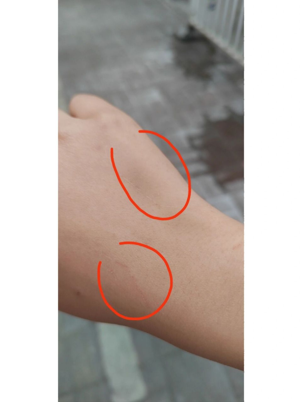 这种伤口要打狂犬疫苗吗08