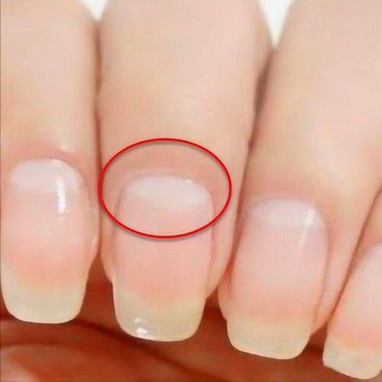 有些人天生就指甲月牙较小或不明显,这并不意味着他们身体不健康.