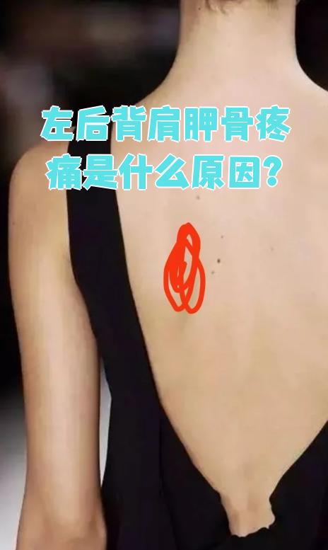 左后背肩胛骨疼痛常见原因包括肌肉问题,神经压迫,关节疾病,骨骼
