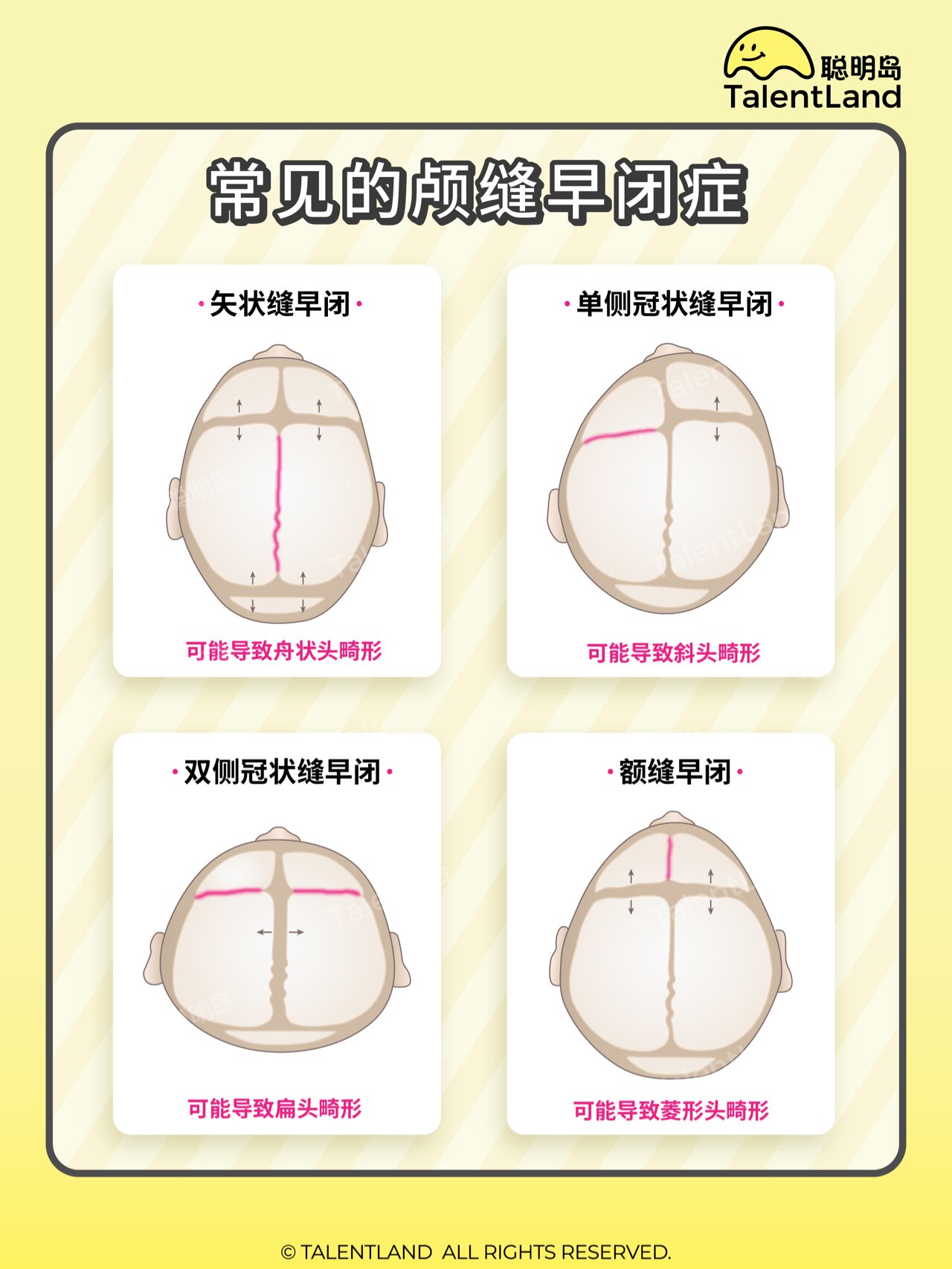 单侧冠状缝早闭图片