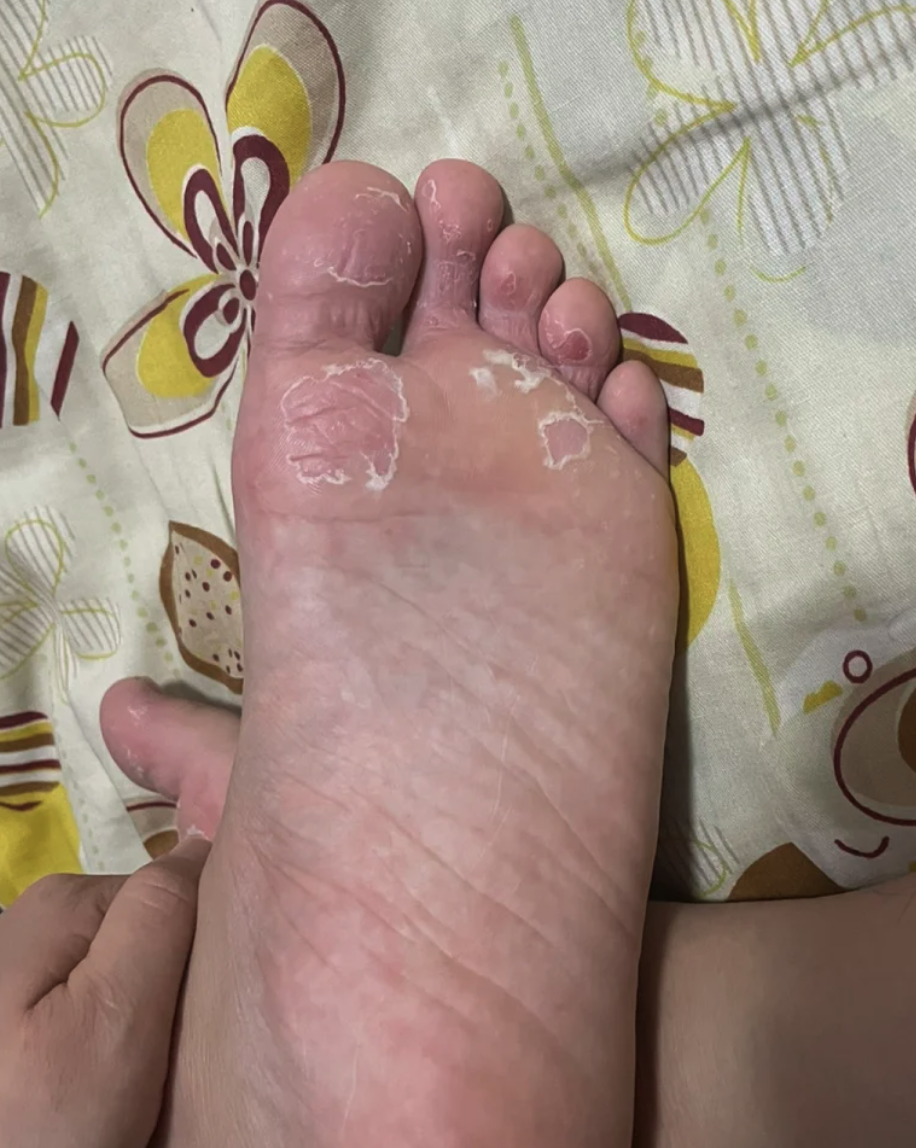 需要根据症状判断原因,再针对性处理