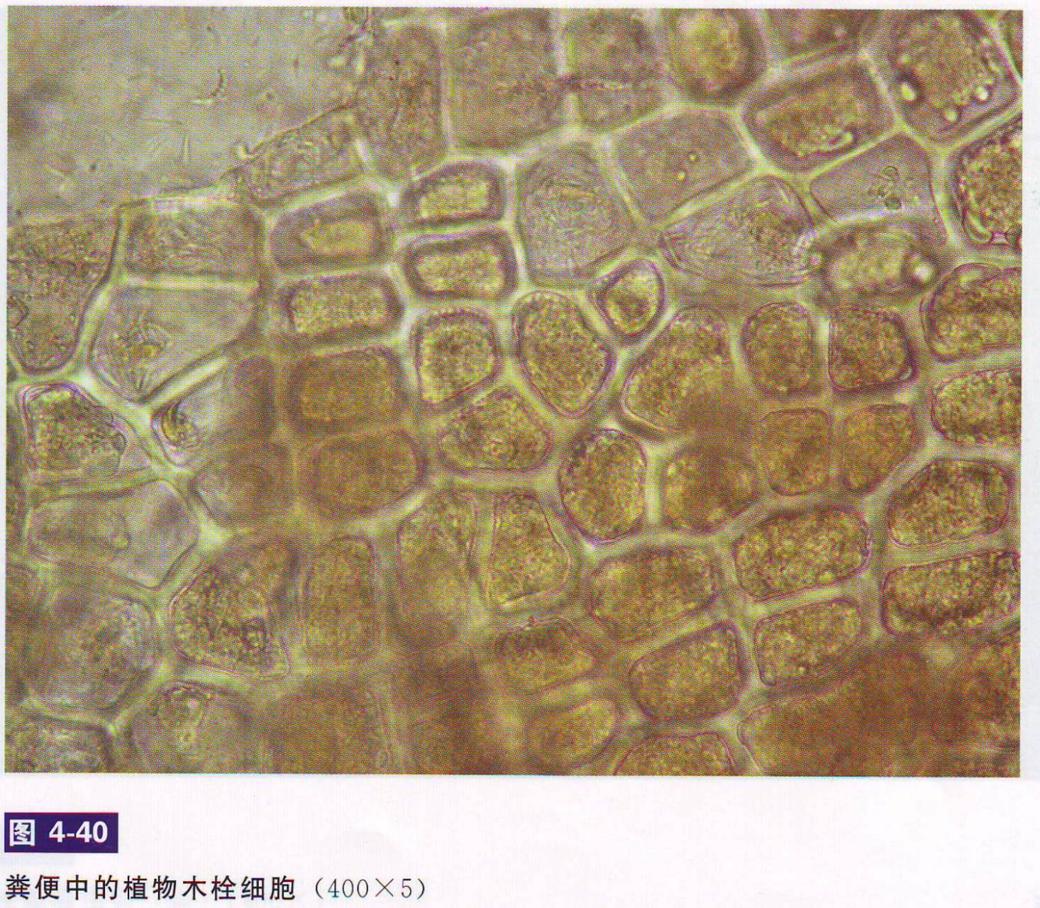 犬猫——粪便检查46615(植物细胞,菌类) (图片取自书籍,仅供个人