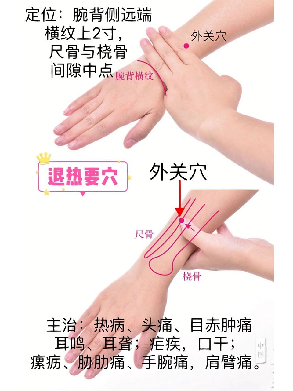 一天记一个穴位—外关 外关穴,络穴;八脉交会穴,通阳维脉,属手少阳