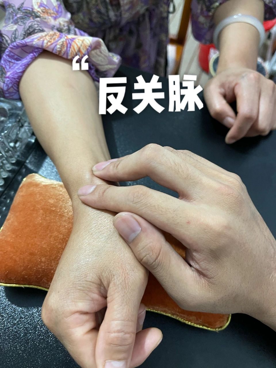 今天遇到了人生中第一个反关脉的病人.