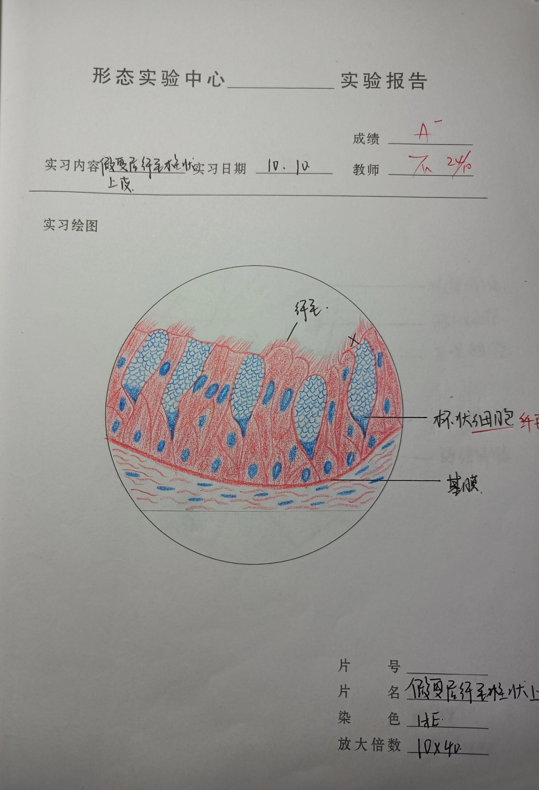 变移上皮 结构图图片