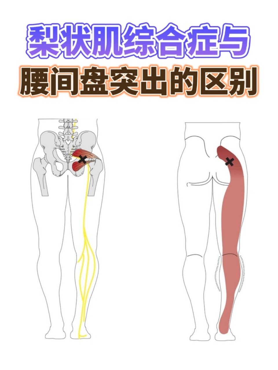 左侧腰部肌肉凸起图片图片