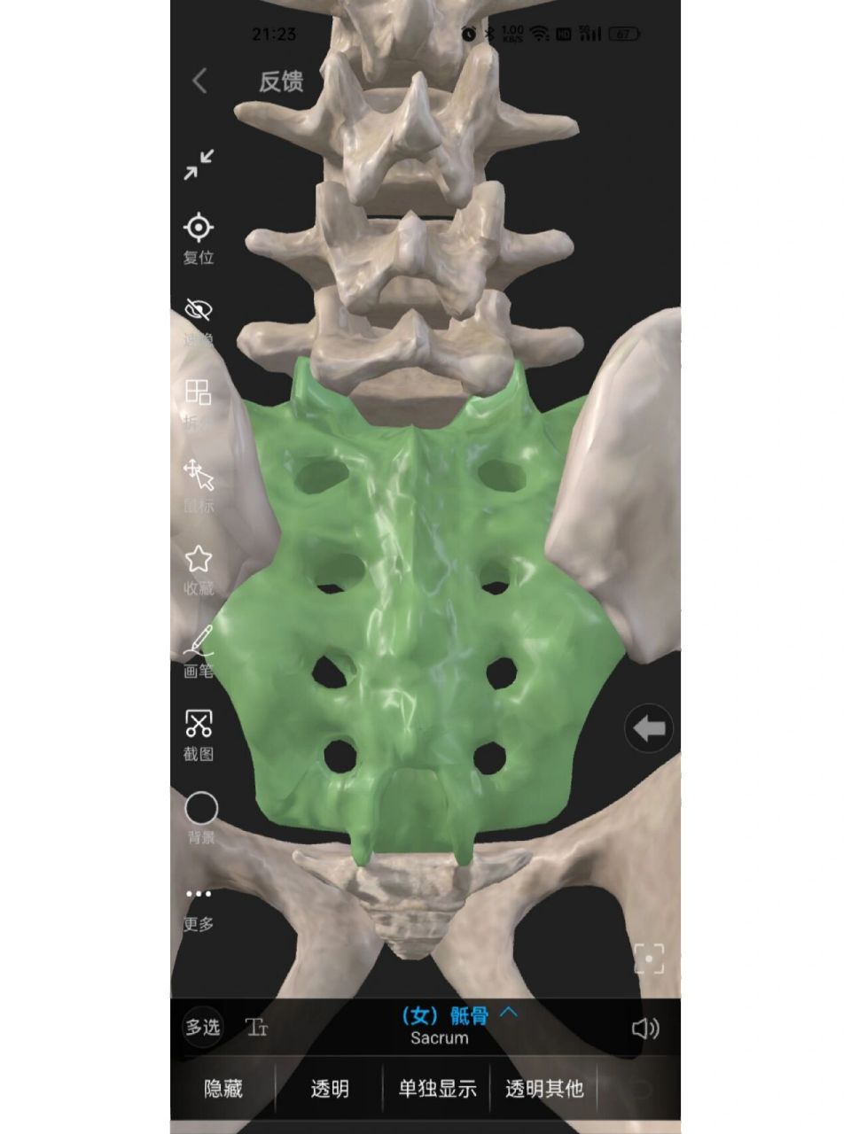 骶管麻醉方法 help! 我打骶管麻醉老是不得要领,有什么秘诀吗01