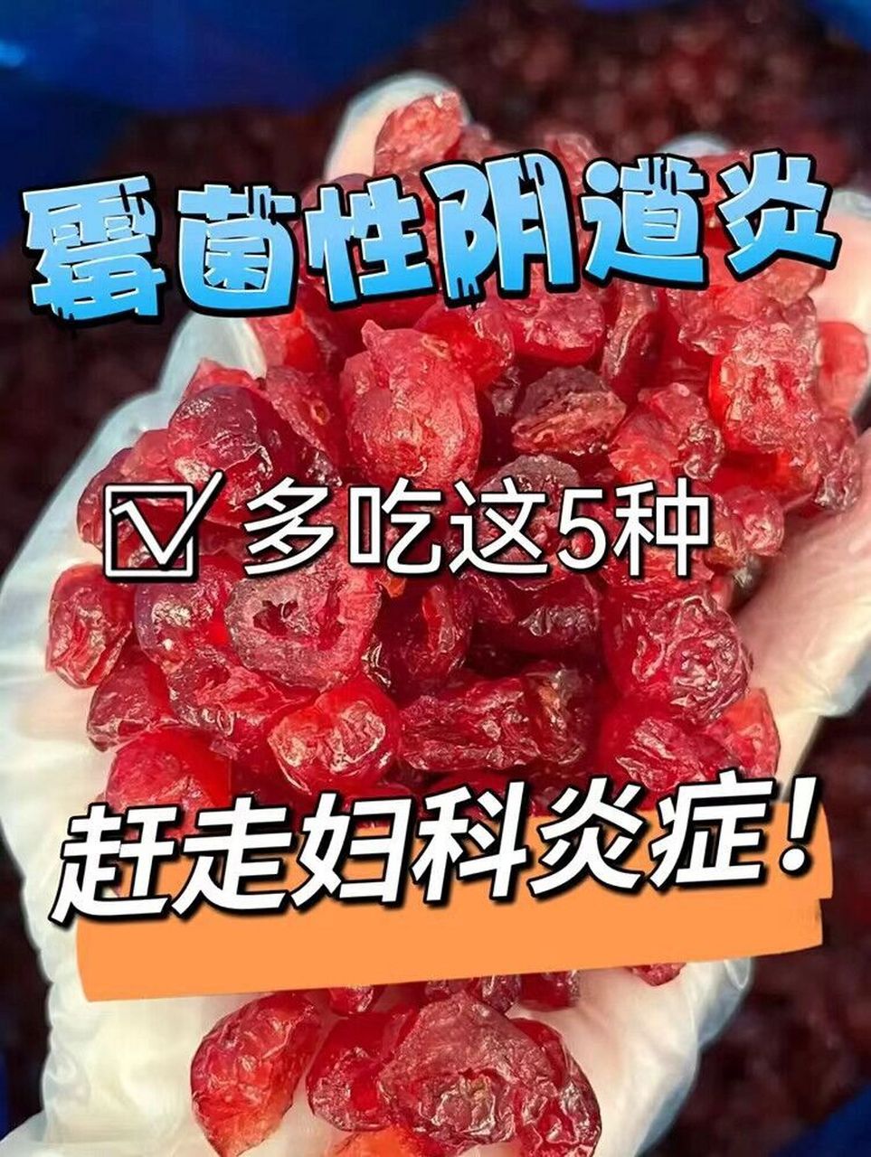 949494 对于感染霉菌性阴道炎的女生,可以在生活中吃五种食物