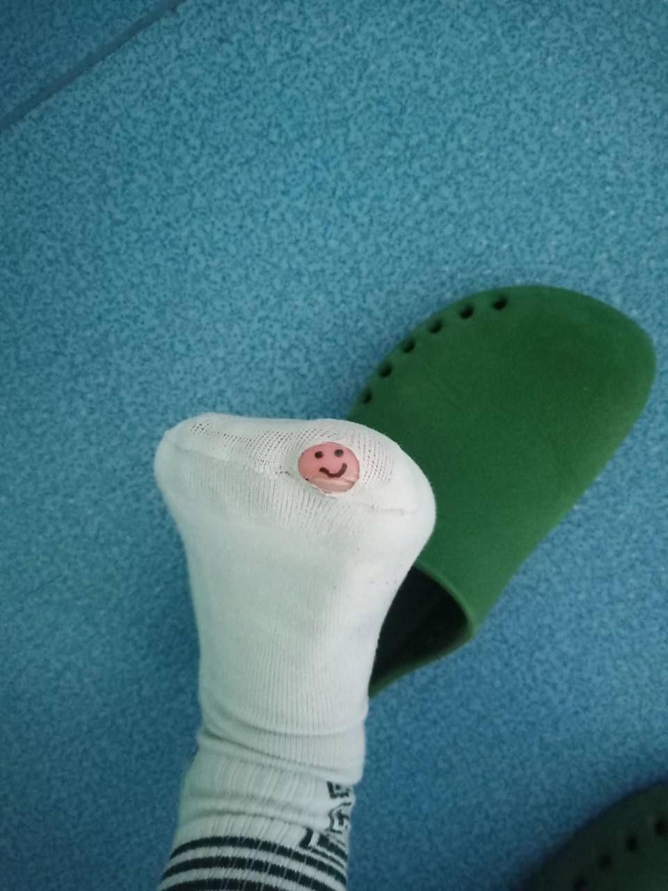 袜子为什么老是破洞 袜子破一个洞咋办,你们换新还是缝缝补补,我的大