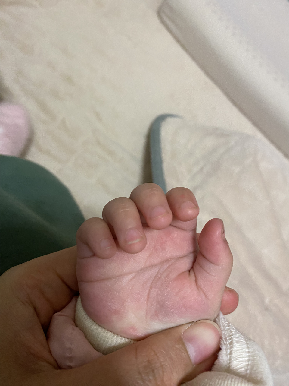 宝宝掌纹 刚出生就发现我家宝宝双手断掌,以为长大会好点,现在1岁差不