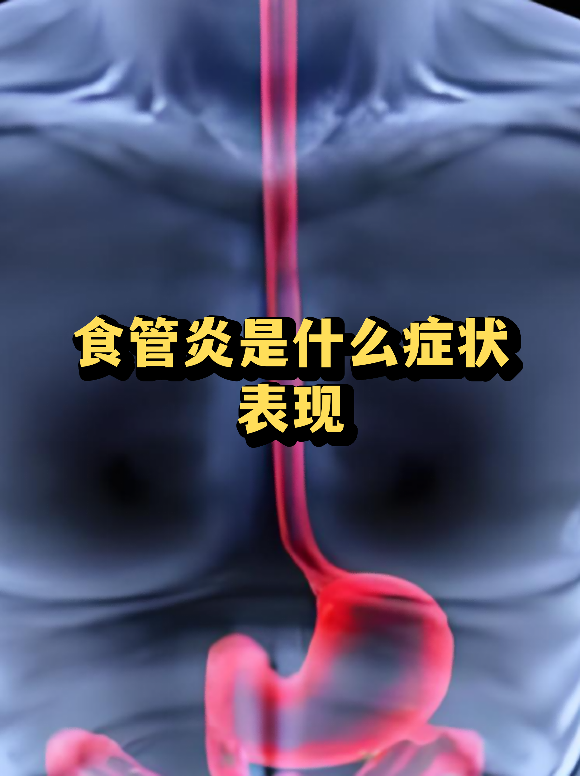  最近突发疾病(最近突发疾病死亡)
