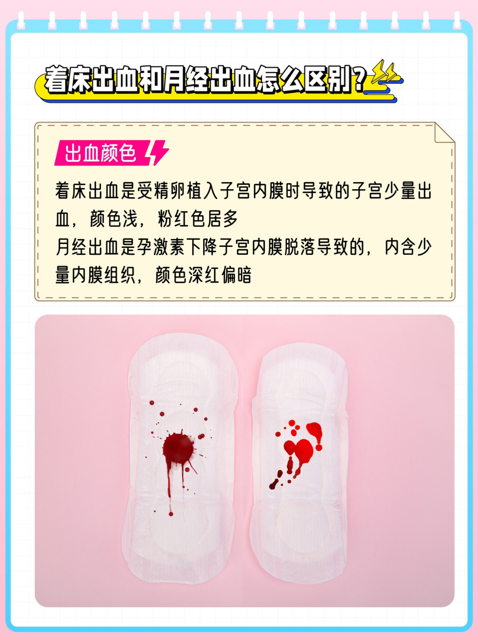 看这4点就行 着床出血和月经出血怎么区别?