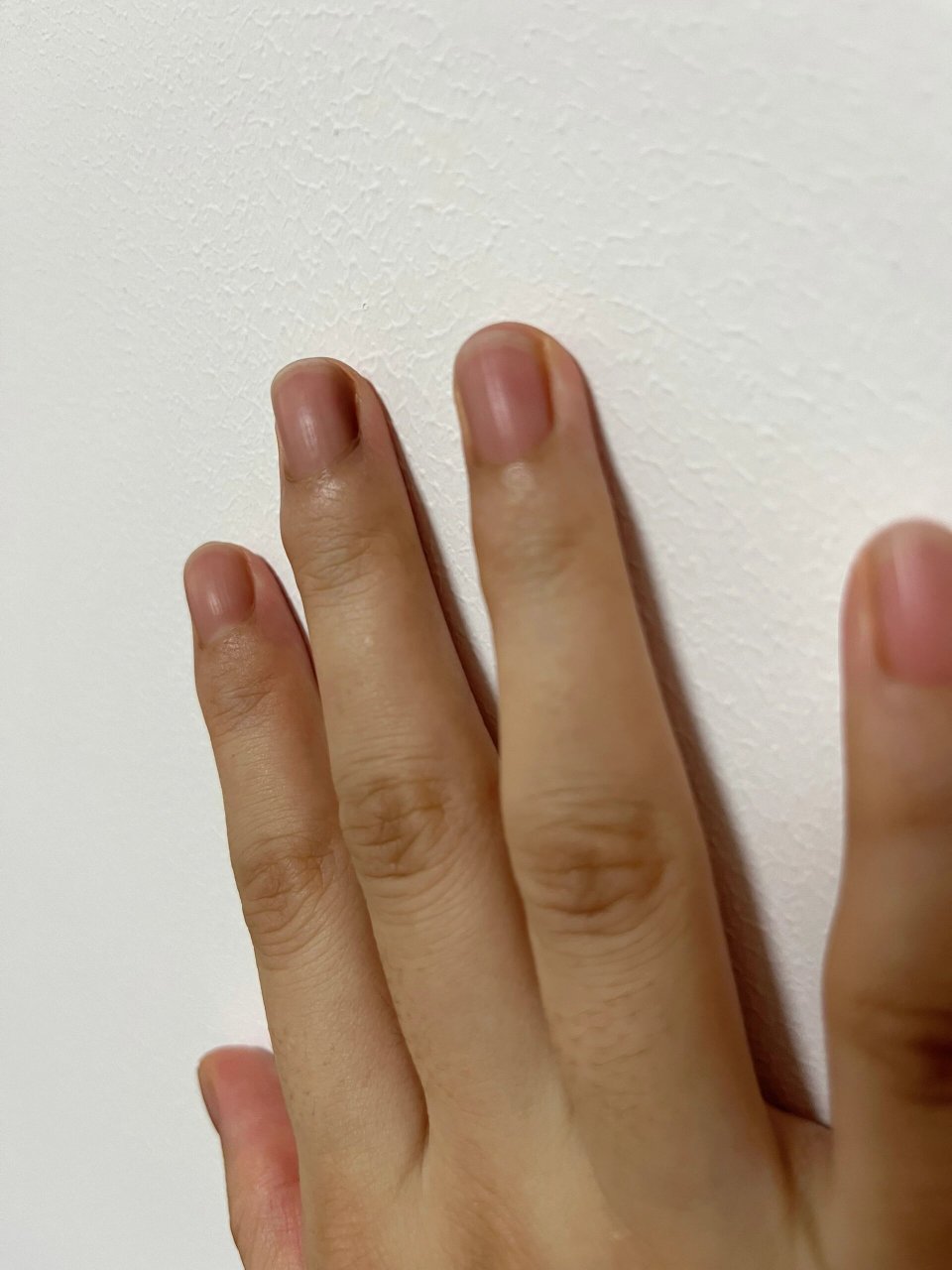 生完孩子后指甲变黑 姐妹们,生完孩子后突然有一天发现中指指甲侧面变