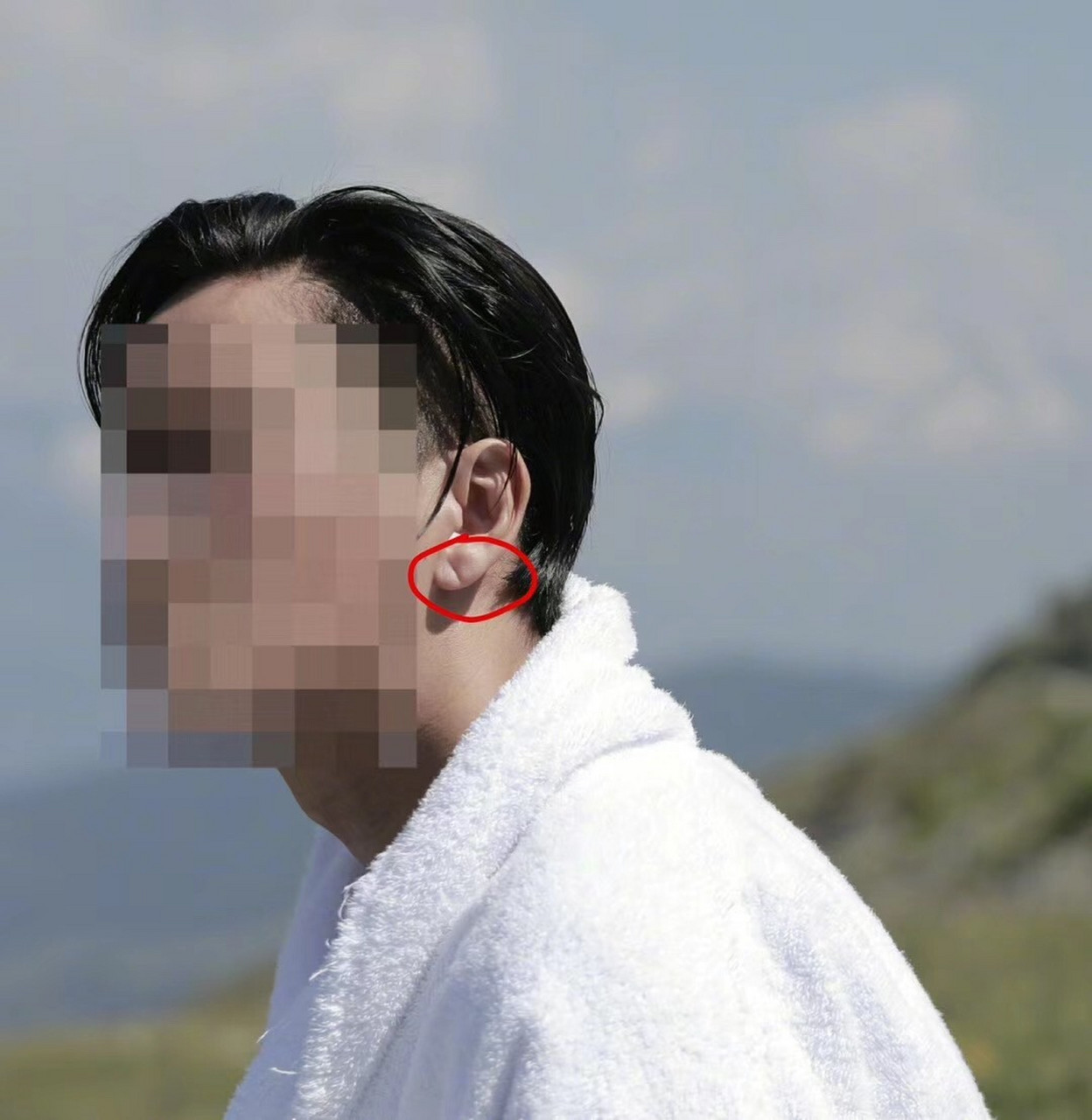 耳垂有横纹,斜纹,代表有心脑血管方面暗疾,爆发心脑血管疾病的可母哌