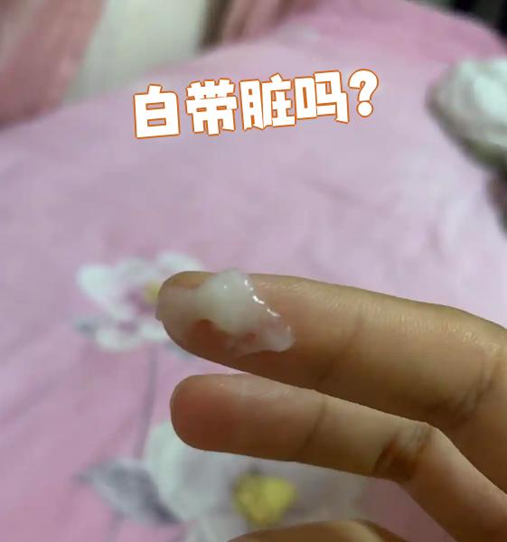 健康的白带一般是透明或乳白色的,而且没有难闻的气味