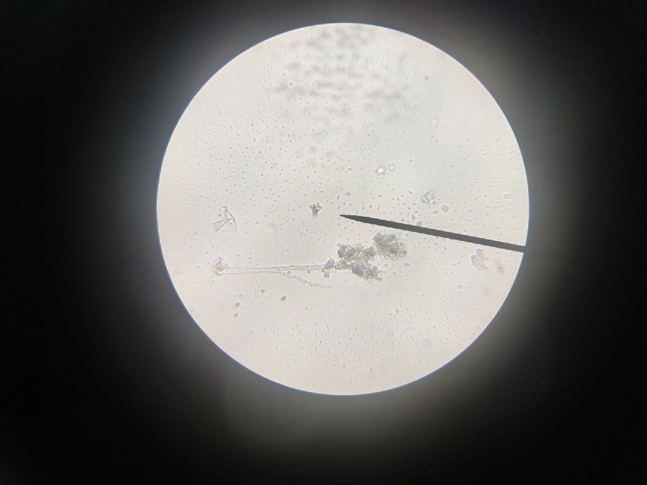 显微观察青霉菌