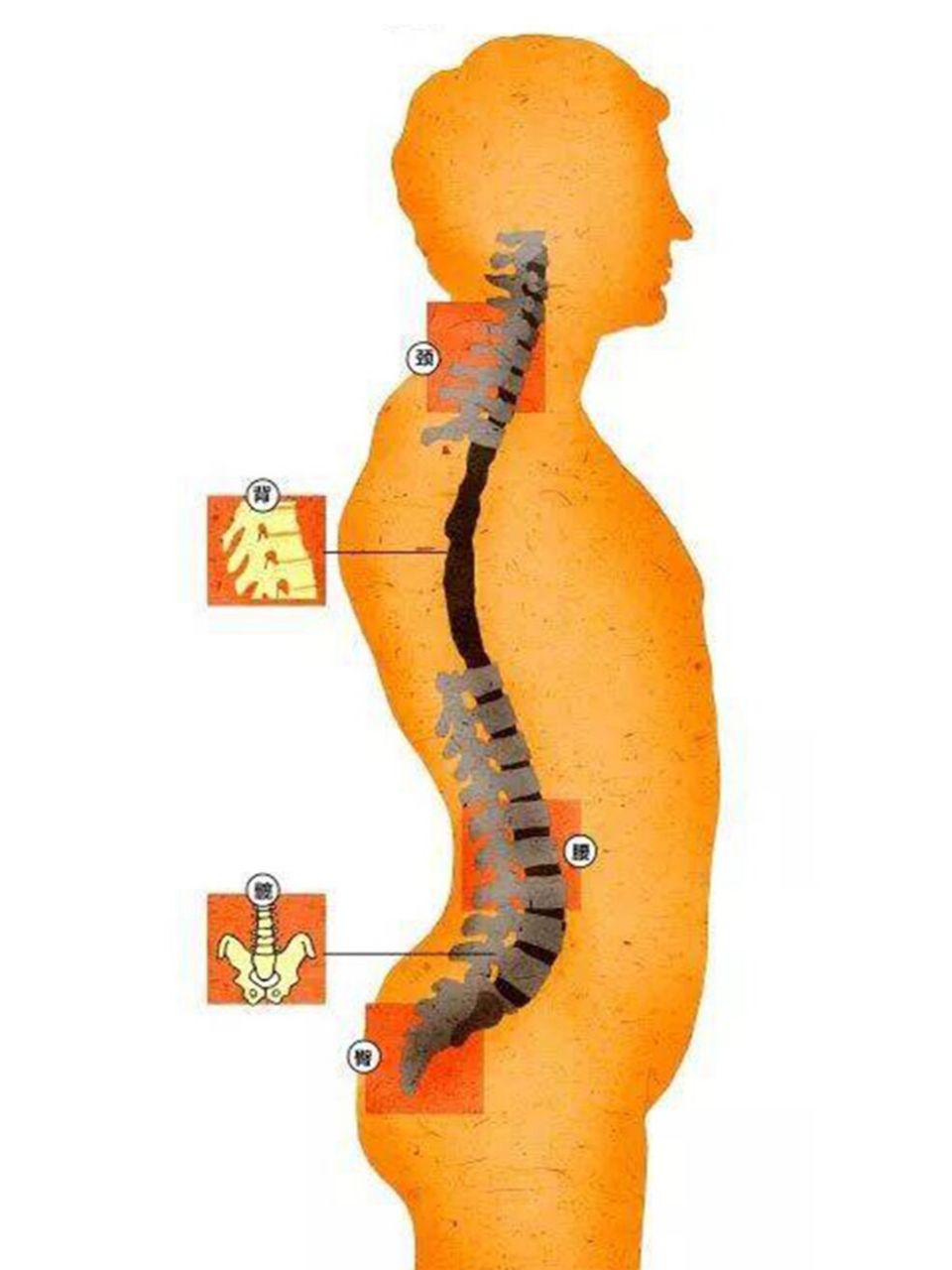 强直性脊柱炎可出现以的11种症状 大家好,我是北京公立三甲医院-风湿