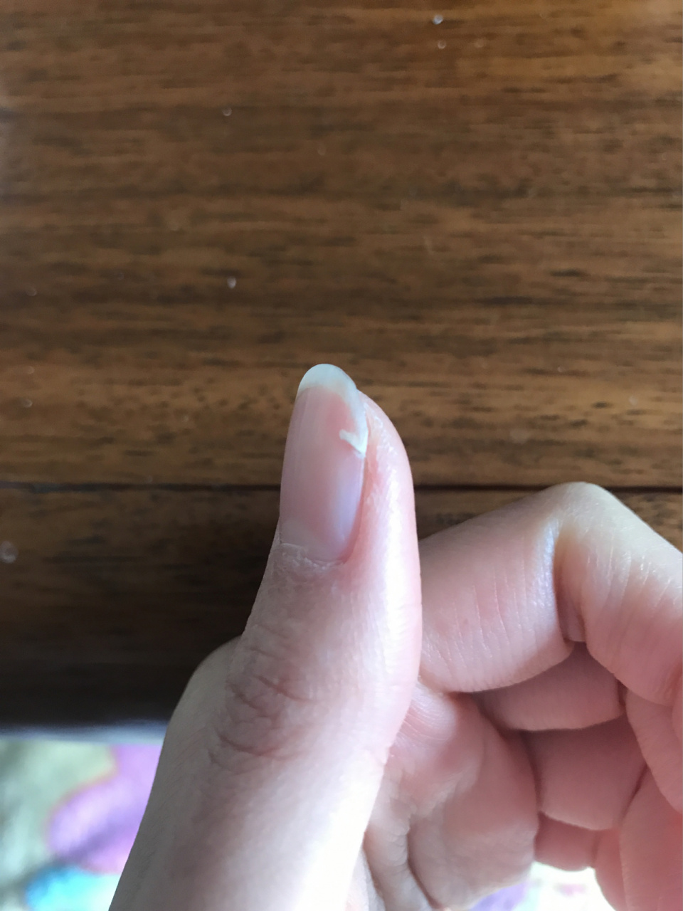 指甲断裂怎么办?