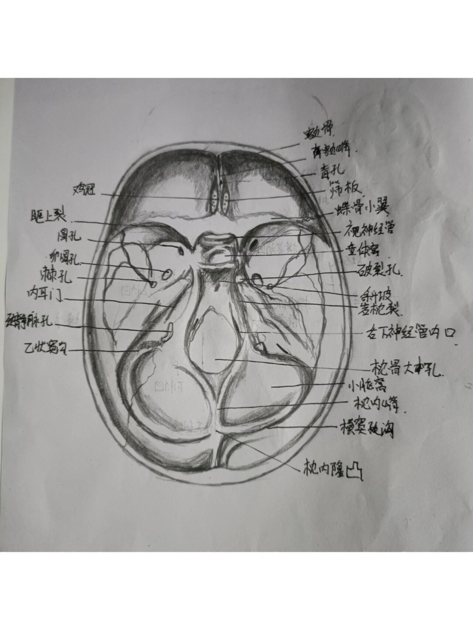 大脑半球外侧面素描图片