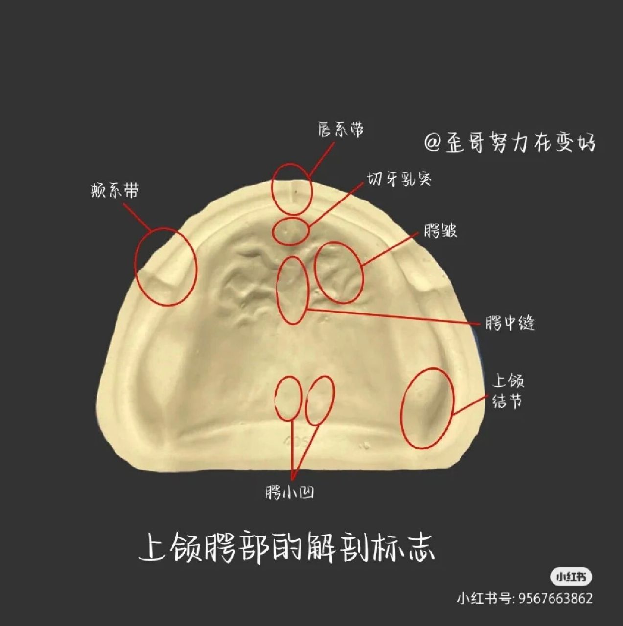 硬腭凸起图片