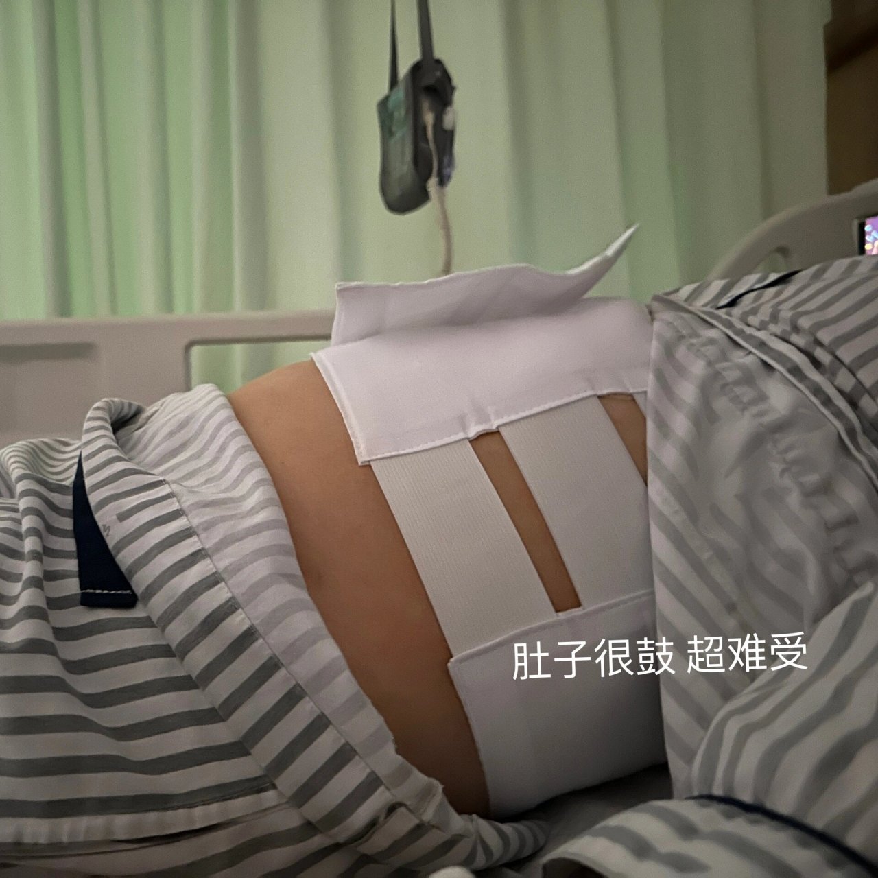 胃食管反流专科 胃底折叠术 当天晚上 下午还跟没事的人一样 觉得好像